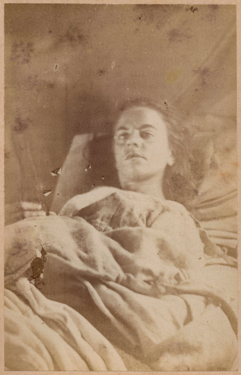 Epilepsja histeryczna, atak, trzeci okres, płyta XXVI z „Iconographie Photographique de La Salpetriere” Bourneville et P. Regnard, Paryż, 1876 (druk albumowy) autorstwa Paul Regnard