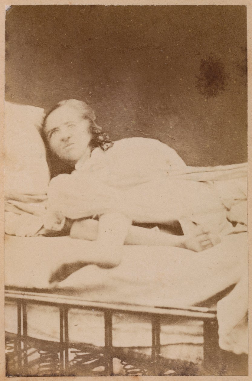 Epilepsja histeryczna, wykrzywienia, klisza XXXVIII z „Iconographie Photographique de La Salpetriere” Bourneville i P. Regnard, Paryż, 1876 (druk albumowy) autorstwa Paul Regnard