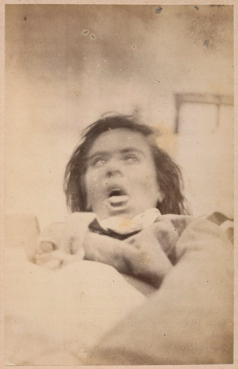 Epilepsja histeryczna, halucynacje, udręka, płyta XXIX z „Iconographie Photographique de La Salpetriere” Bourneville