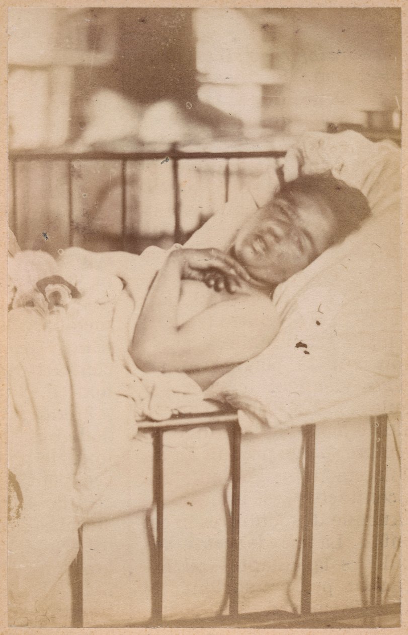 Padaczka histeryczna, stały skurcz, płyta XXVIII z „Iconographie Photographique de La Salpetriere” Bourneville i P. Regnard, Paryż, 1876 (druk albumowy) autorstwa Paul Regnard
