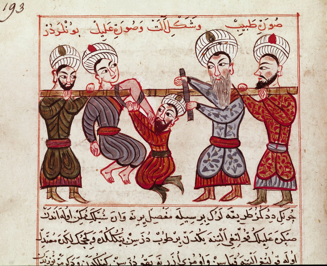 Medycyna: interwencja ortopedyczna. Miniatura zaczerpnięta z dojenia tureckiej medycyny przez Charaf-ed-din (Charaf ed Din) (1404-1468) po „”La Surgery Imperiale”” (Ms Sup Turk 693 fol. 193) 1466 Paris, B.N. autorstwa Persian School