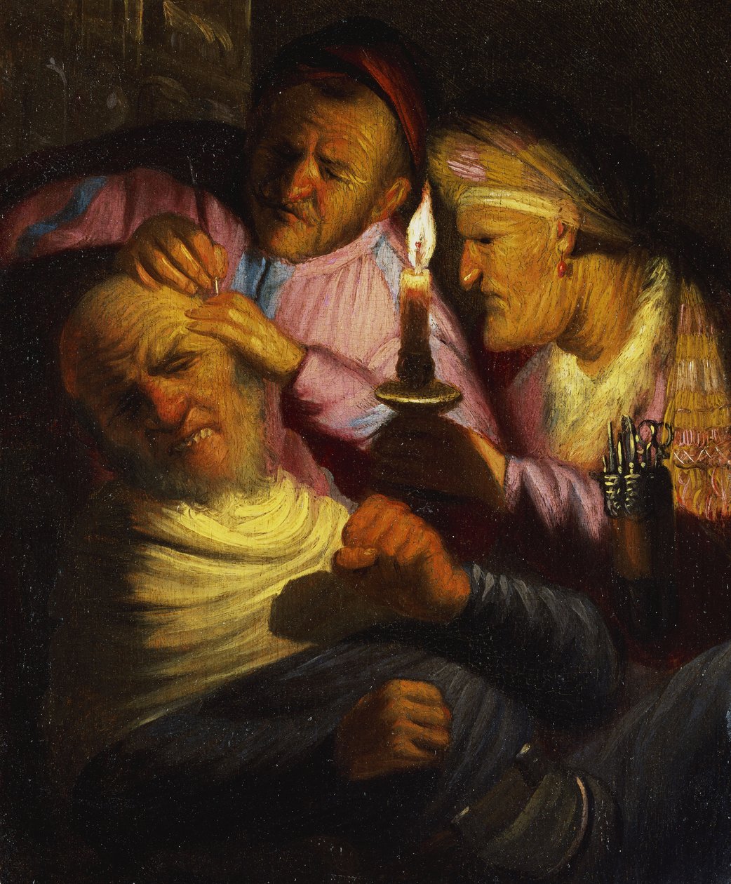 Zmysł dotyku: operacja kamienia autorstwa Rembrandt van Rijn