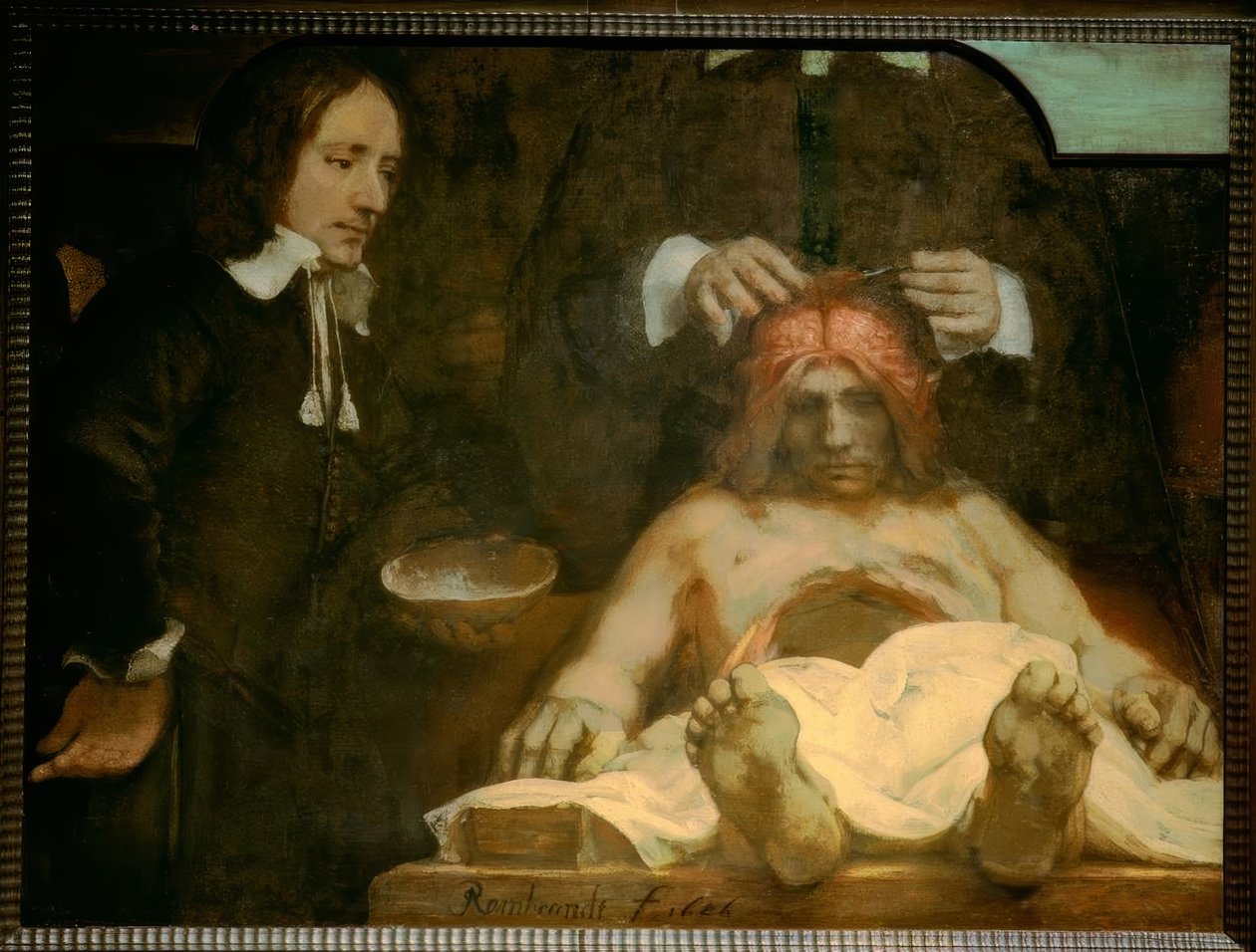 Anatomia dr Johana Deijmana autorstwa Rembrandt van Rijn