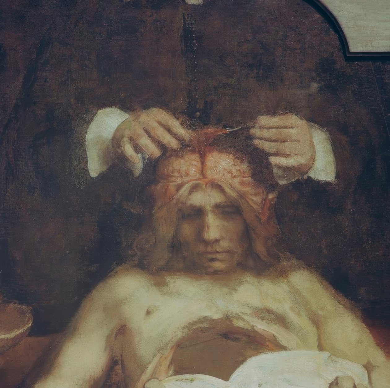 Anatomia dr. Johan Deijman autorstwa Rembrandt van Rijn