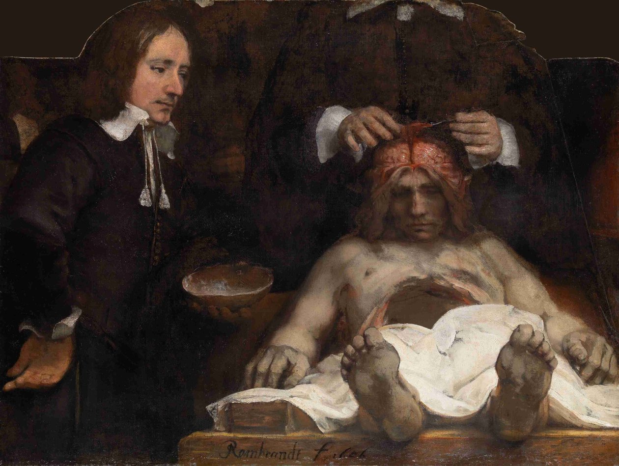 Lekcja anatomii dr Jana Deijmana, 1656 r. autorstwa Rembrandt van Rijn