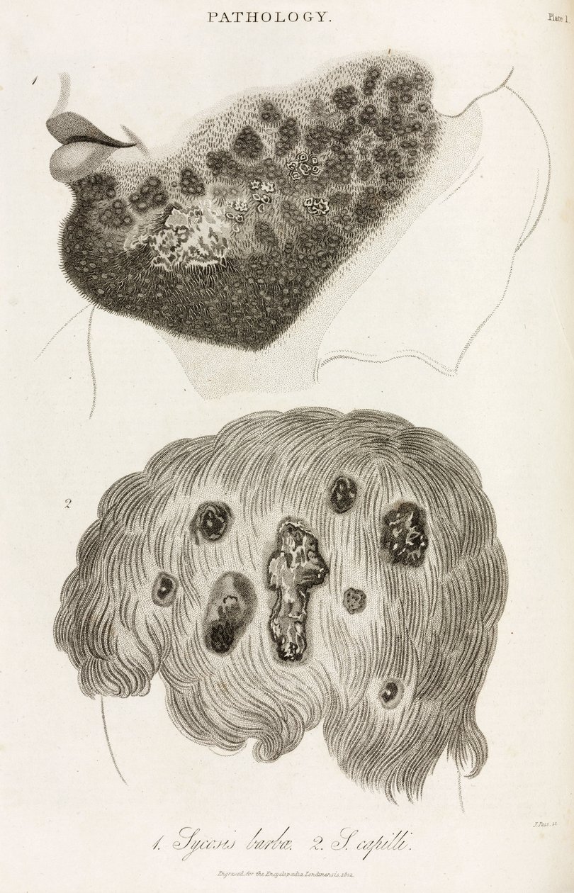 Dermatologia Choroby skóry autorstwa John Pardon