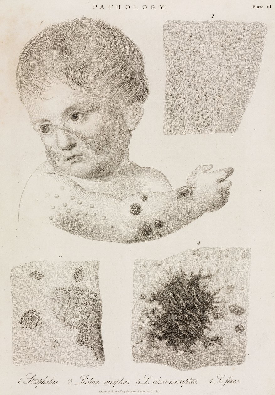 Dermatologia Rodzaje chorób skóry autorstwa John Pardon
