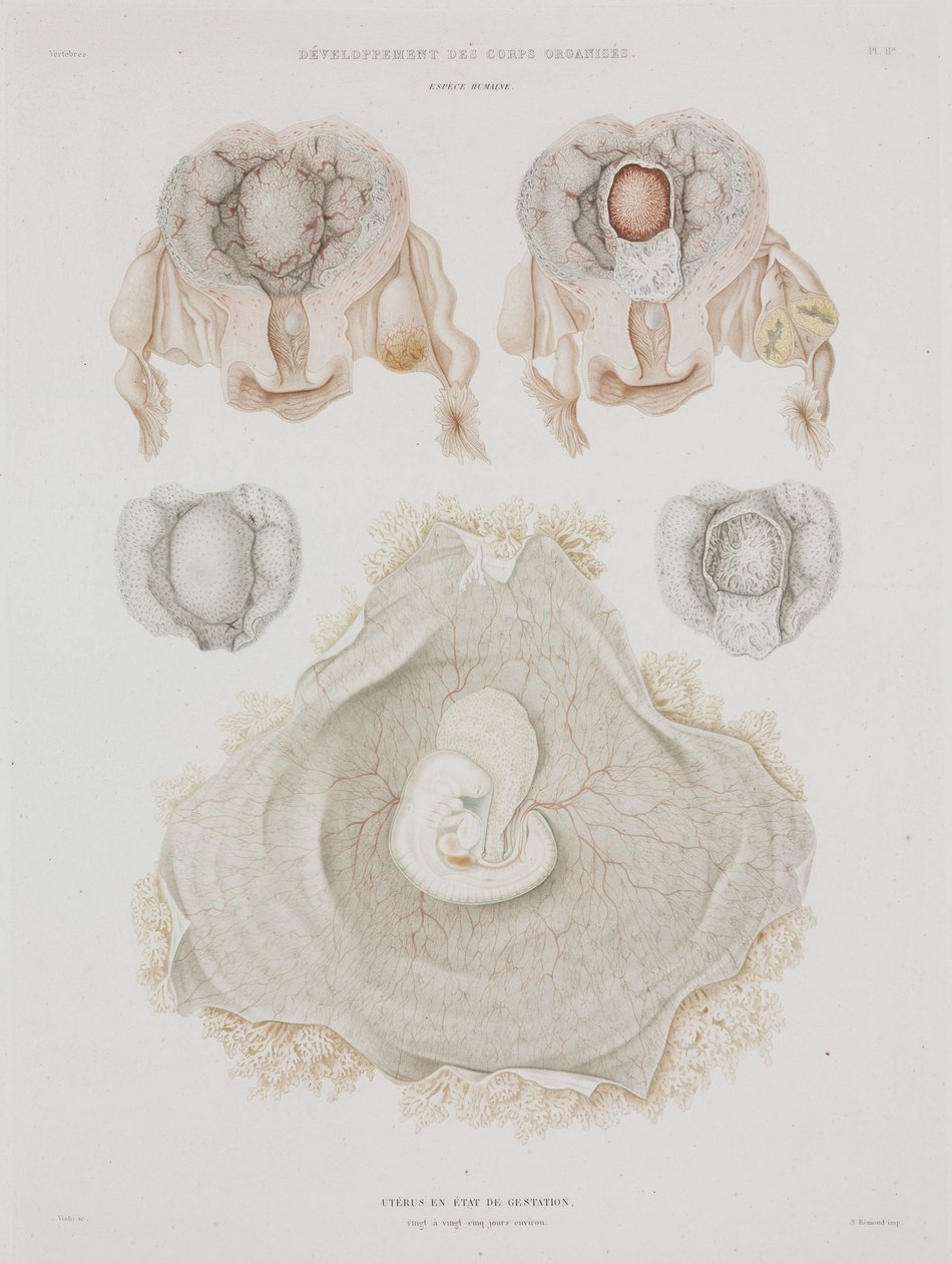 Ginekologia Ludzka macica z zarodkiem, ok. 1847-1859 autorstwa John Pardon