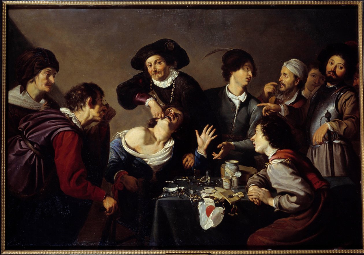 Narzędzie do usuwania zębów Dentysta otacza swoich asystentów, a instrumenty rozrywają ząb pacjenta. Obraz Theodore Rombouts autorstwa Theodor Rombouts