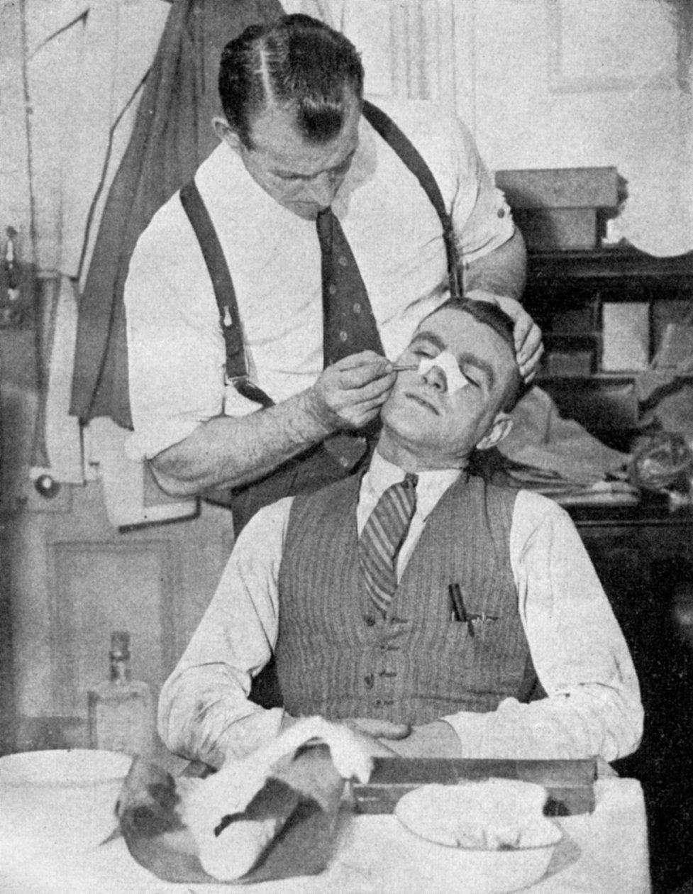 Kapitan Anglii Eddie Hapgood otrzymuje leczenie złamanego nosa po meczu z Włochami w 1934 roku. autorstwa Topical Press Agency