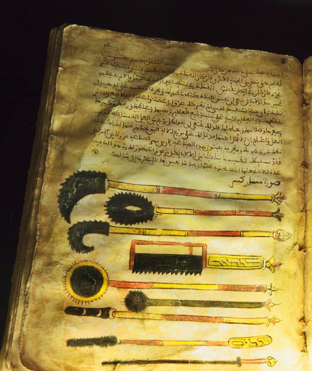Ilustracja z „O chirurgii i instrumentach” lub „Al-Zahrawi”, autorstwa Abu al-Qasima al-Zahrawiego autorstwa Unbekannt Unbekannt