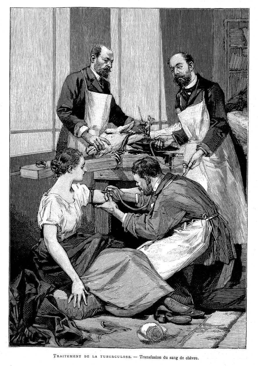 Chory na gruźlicę otrzymujący transfuzję koziej krwi, 1891 autorstwa Unbekannt