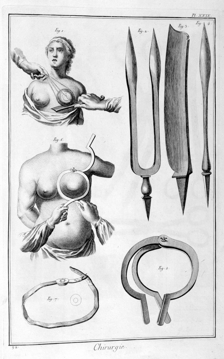 Operacja piersi, 1751-1777 autorstwa Unbekannt