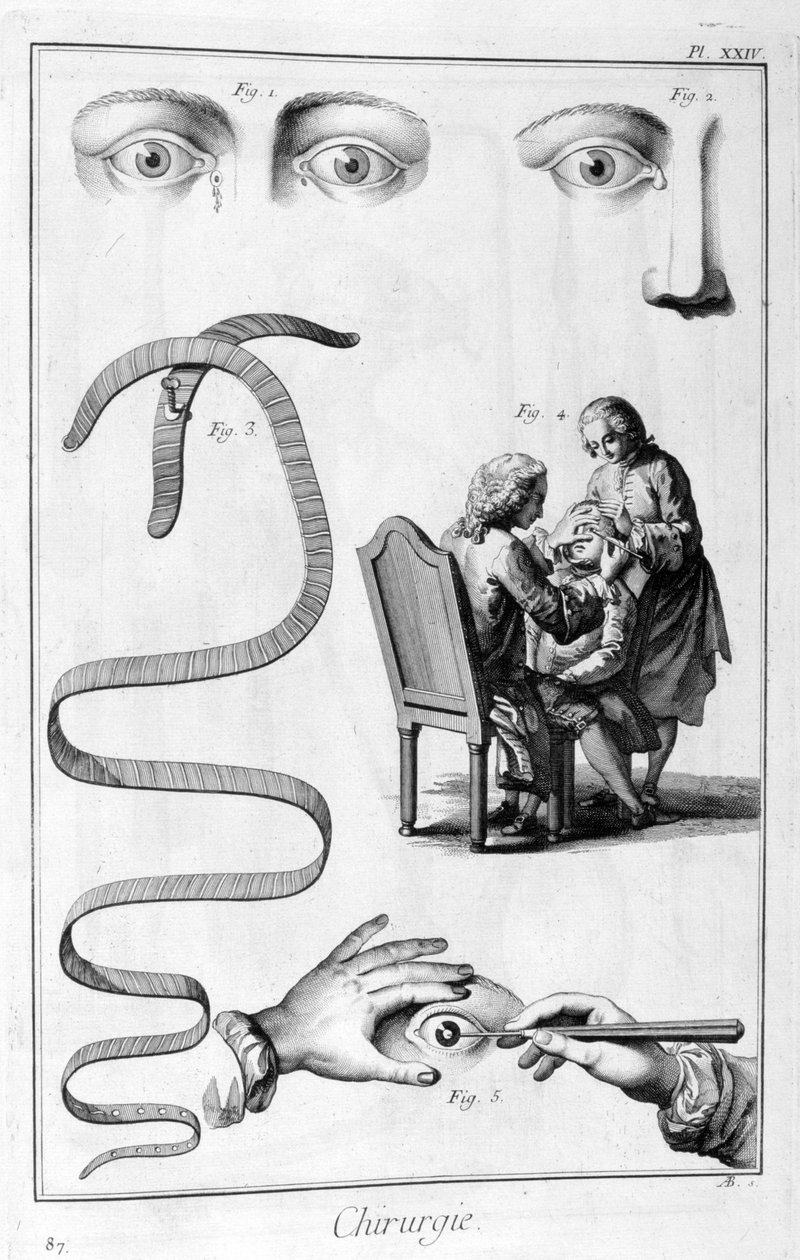 Chirurgia oka, 1751-1777 autorstwa Unbekannt