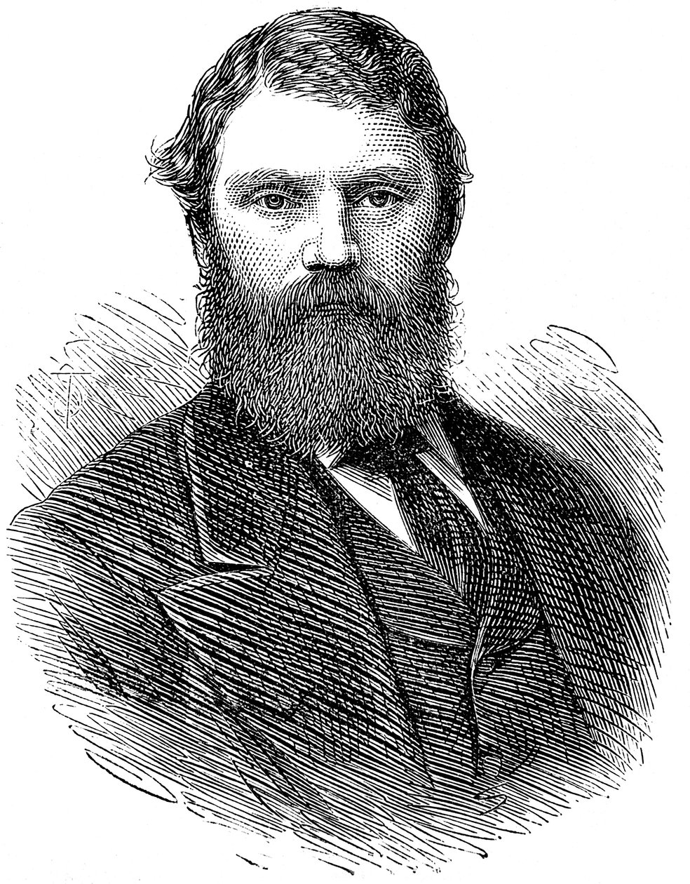 Francis Edmund Anstie 1833-1874, angielski lekarz, 1874 autorstwa Unbekannt