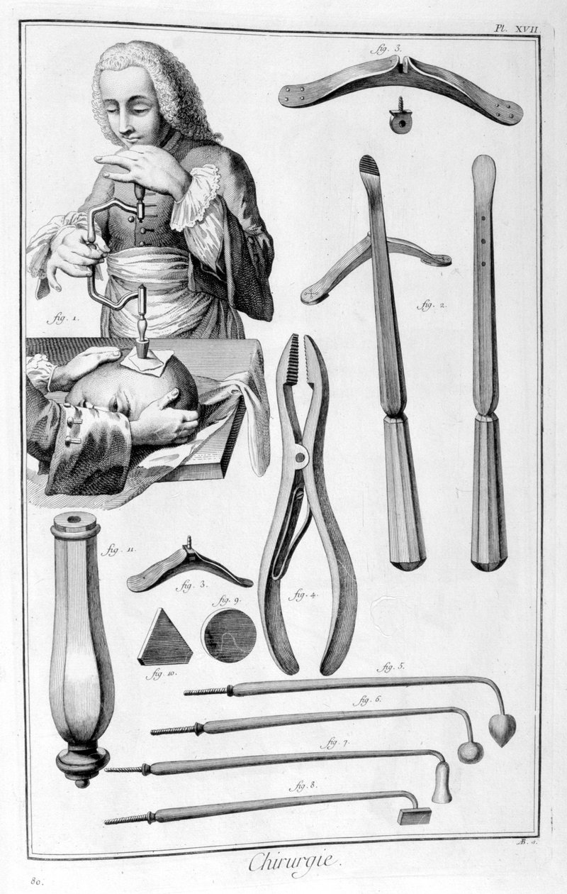 Chirurgia głowy, 1751-1777 autorstwa Unbekannt