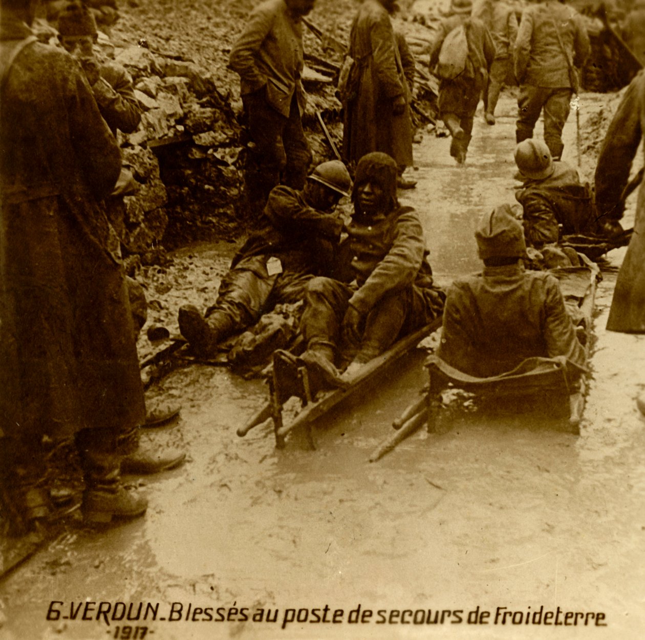 Ranni żołnierze w punkcie sanitarnym, Froideterre, Verdun, północna Francja, 1917 autorstwa Unbekannt