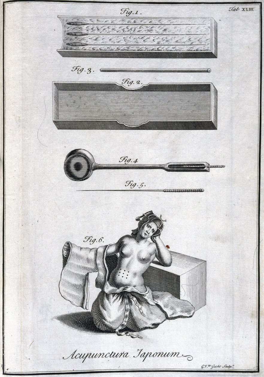 Medycyna alternatywna: tabliczka przedstawiająca igły do ​​akupunktury i ich zastosowanie, grawer z „Historii Japonii” (1727) Engelberta Kaempfera (1651-1716) (Igły do ​​akupunktury i ich zastosowanie, ok. 1690 Grawer G van der Gucht fig. autorstwa Unbekannt