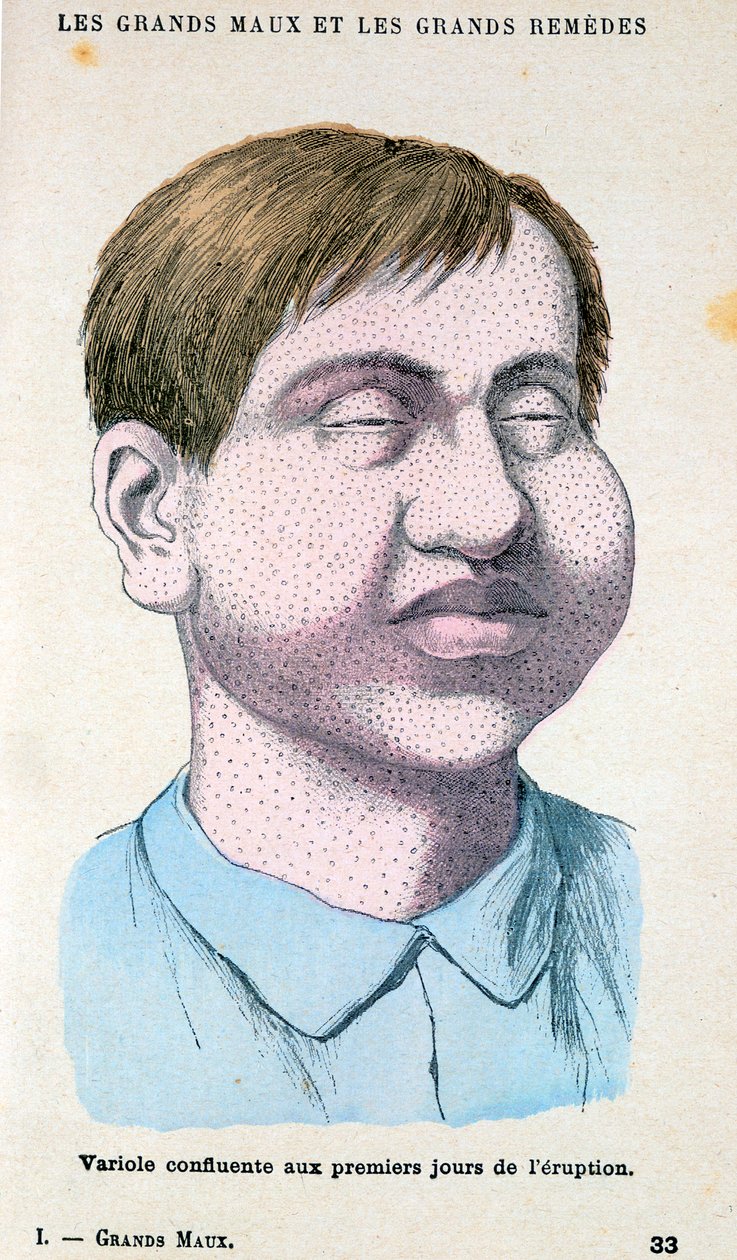 Ofiara ospy, c1890 autorstwa Unbekannt