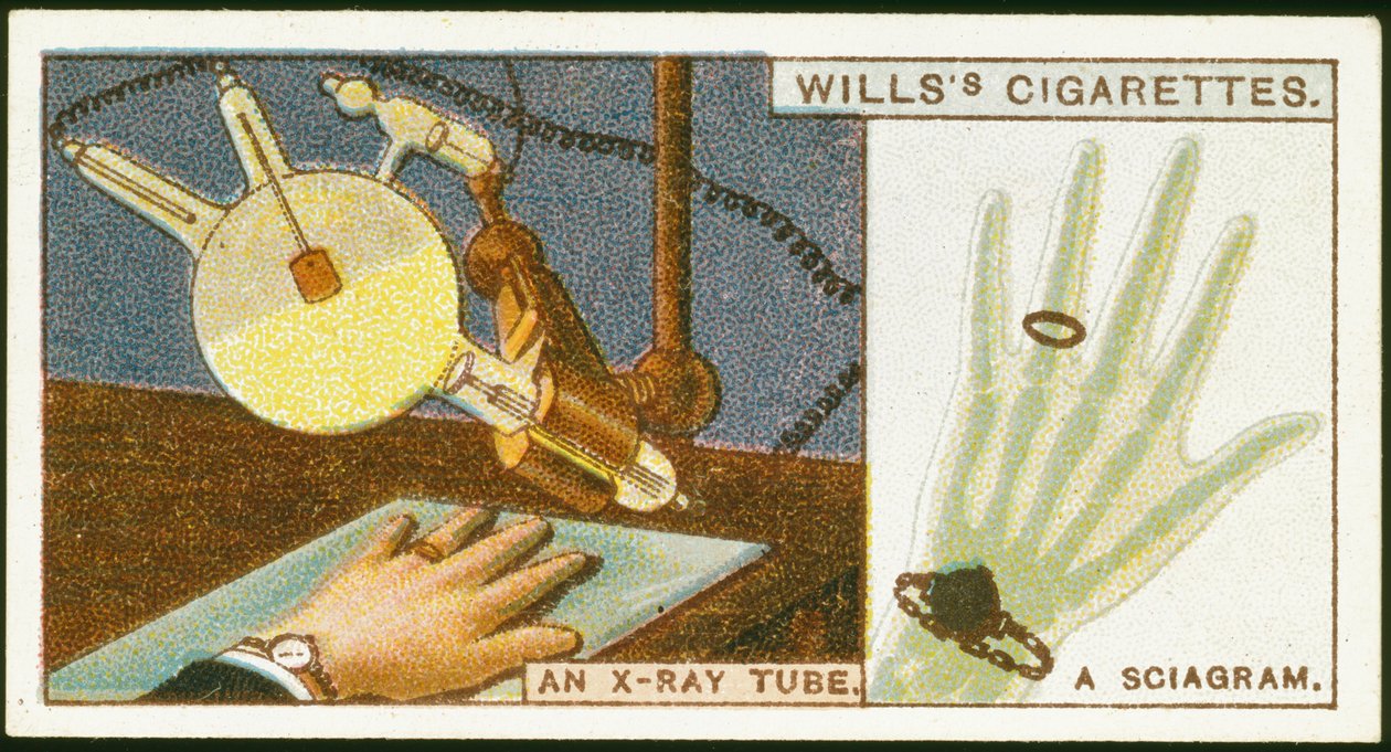 Prześwietlenie ręki, 1924 autorstwa Unbekannt