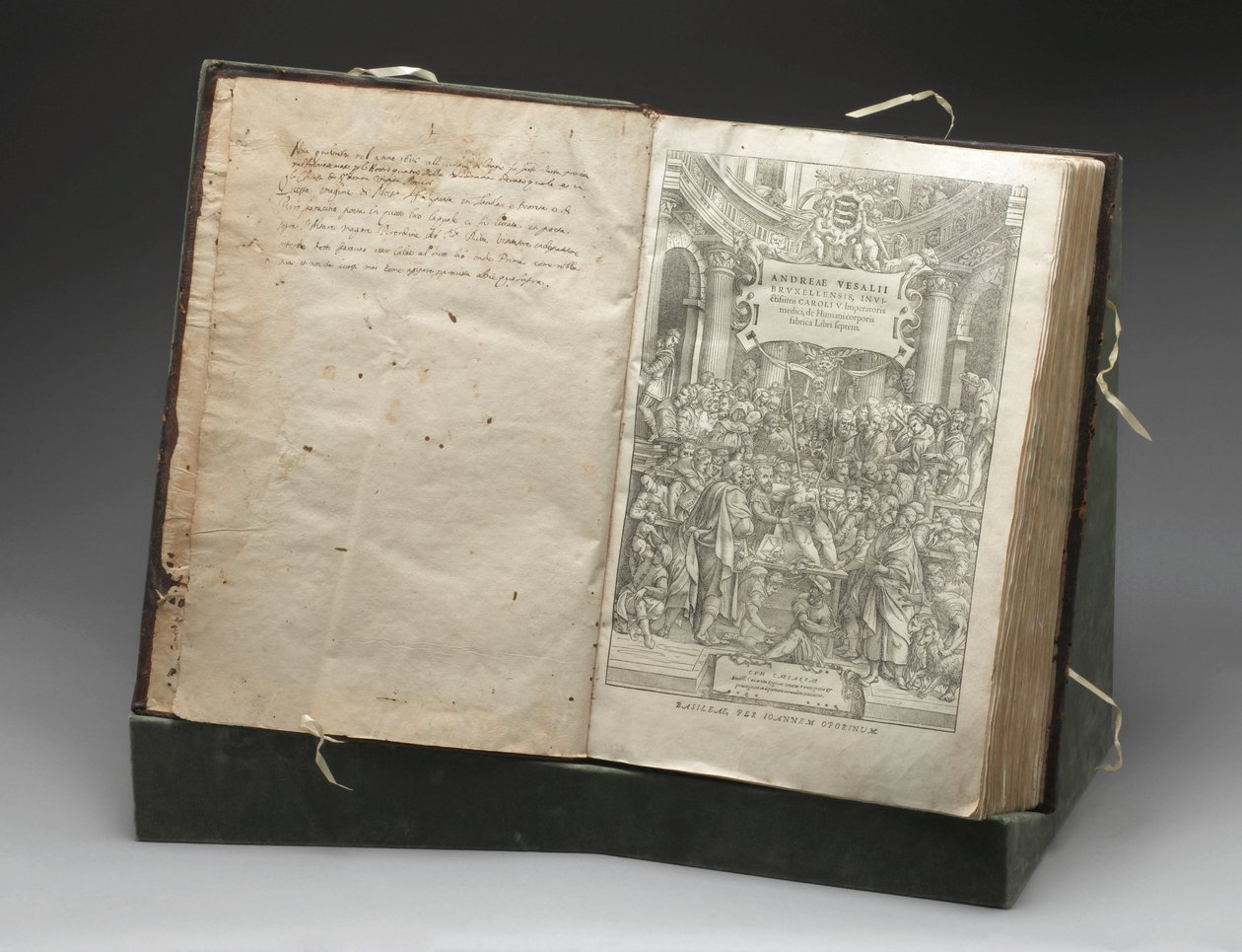 Patologia, Sekcje Drzeworyt Andreasa Vesaliusa rozcinającego zwłoki autorstwa Unbekannt