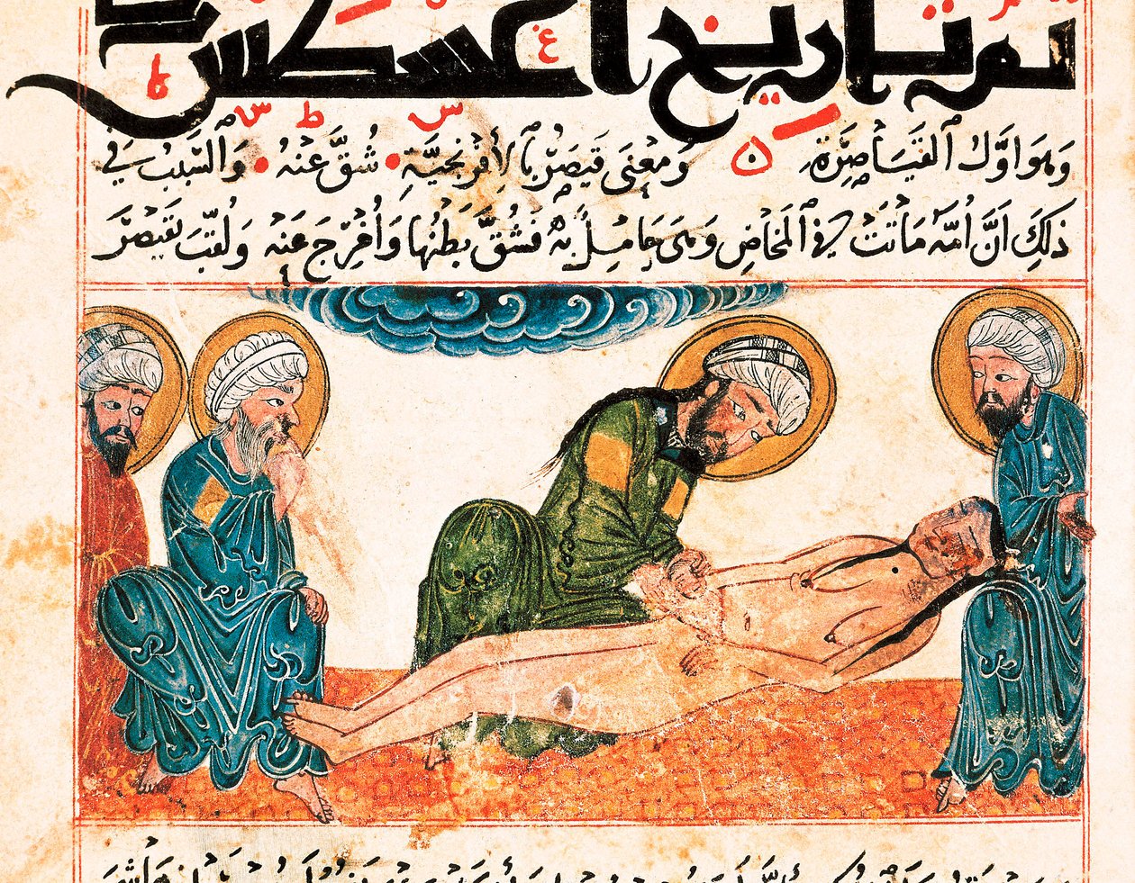 Reprezentacja porodu cesarskiego. Miniatura zaczerpnięta z rękopisu medycyny autorstwa Abu Raihana Al-Biruniego (albo Alberuni) (973-1048), perskiego intelektualisty i naukowca, folio 161. autorstwa Unbekannt