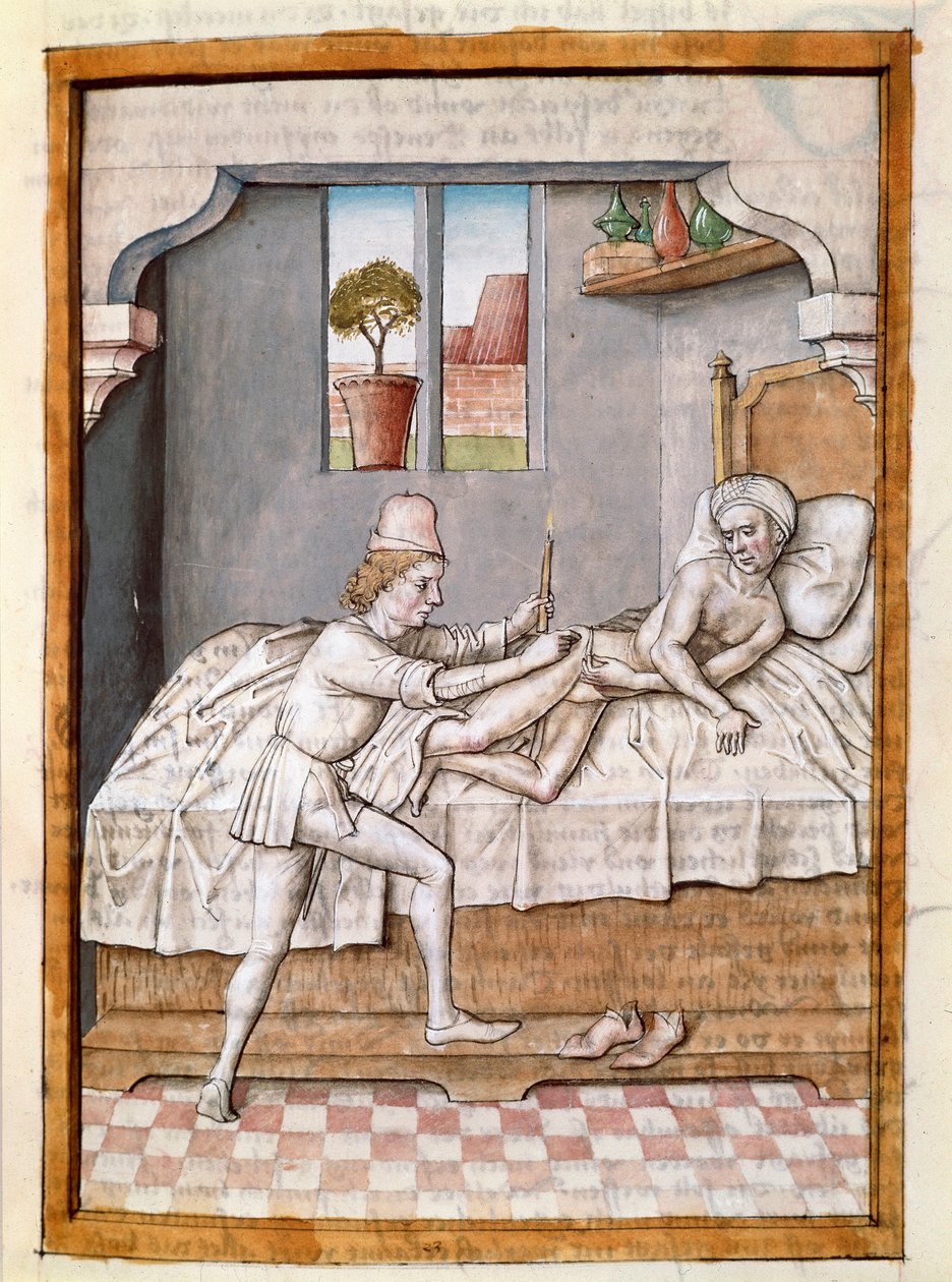 Lekarz leczy miniaturowego pacjenta z niemieckiego tłumaczenia bajek „Kalila (Calila) i Dimna” Bidpaia. (ms. 1389, k. 23) ok. 1480 Chantilly, muzeum Conde autorstwa Unknown artist