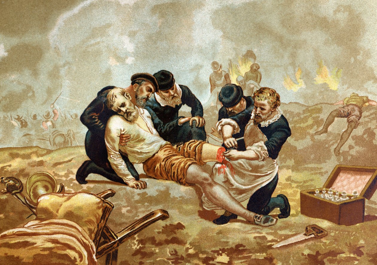 Ambroise Pare Medicine i francuski chirurg (ok. 1509-1590) ćwiczą podwiązywanie tętnic po amputacji. po sławnych mężczyznach i kobietach. Barcelona 1877. autorstwa Unknown artist