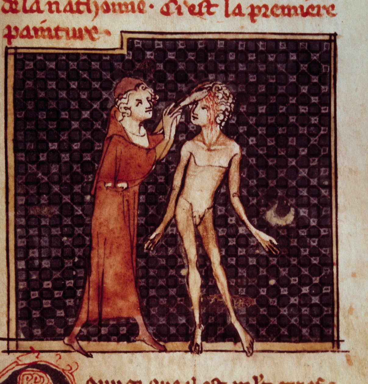 Rysunek anatomiczny: Chirurg nacina czoło pacjenta. Miniatura z rękopisu „Chirurgia” (Folio 8) autorstwa Henri de Mondeville (chirurg profesora anatomii Philippe Le Bel) autorstwa Unknown artist