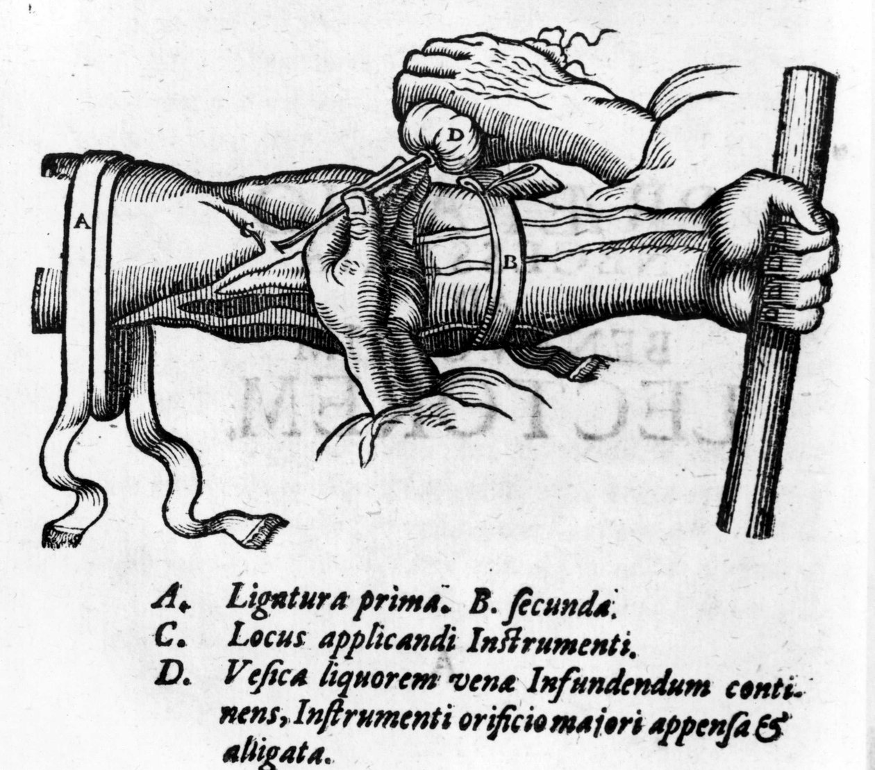 Tablica anatomiczna: różne ligatury. Praca nad układem krwi Williama Harveya (1578-1657), angielskiego lekarza. Opisał krążenie krwi w ciele przez pośrednictwo żył autorstwa Unknown artist