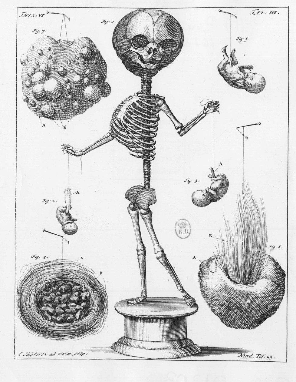 Płytka anatomiczna przedstawiająca szkielet, autorstwa Frederika Ruyscha (1638-1731), holenderskiego anatom. autorstwa Unknown artist