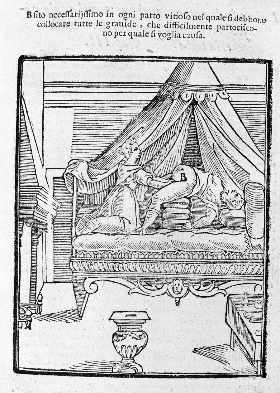 Scena porodu według „Della Commare” Scipione Mercuri autorstwa Unknown artist