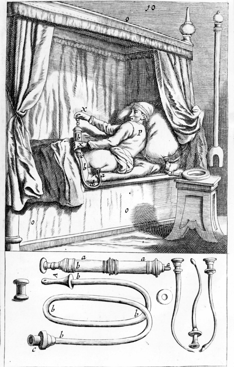 Clystère (do lewatyw) Johannesa Sculptetusa „”Armamentarium Surgical””. Wenecja 1665 autorstwa Unknown artist