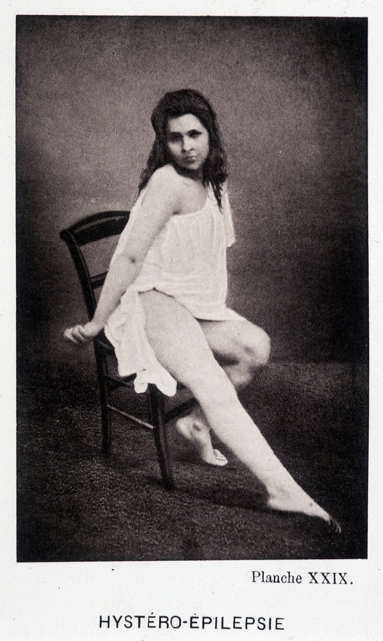 Hystero Epilepsie - Przykurcz w „Ikonografii fotograficznej Salpétrière: służba pana Charcota” autorstwa Paula Regnarda i Bourneville autorstwa Unknown artist