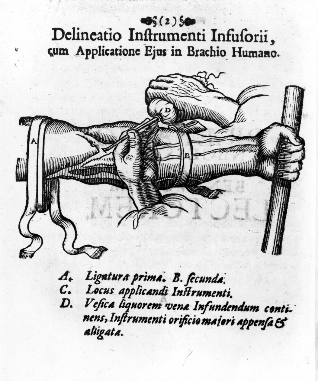 Wstrzyknięcie dożylne z użyciem pęcherza moczowego. JD Mayor, „”Surgery Infusoria””, Kilonii 1667 autorstwa Unknown artist