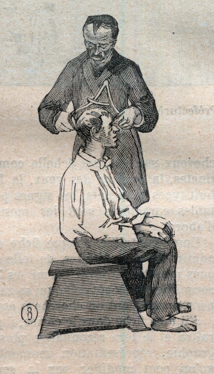 Antropometria sądowa lub bertillonnage, metoda Alphonse Bertillon (1853-1914): pomiar średnicy poprzecznej czaszki - Grawerowanie w „La Science francaise” autorstwa Unknown artist