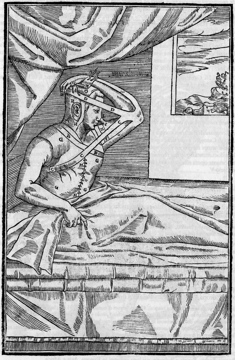 Chirurgia nosa: Chirurgia rekonstrukcyjna nosa w „De curtorum chirurgia per insitionem”. Wenecja autorstwa Unknown artist