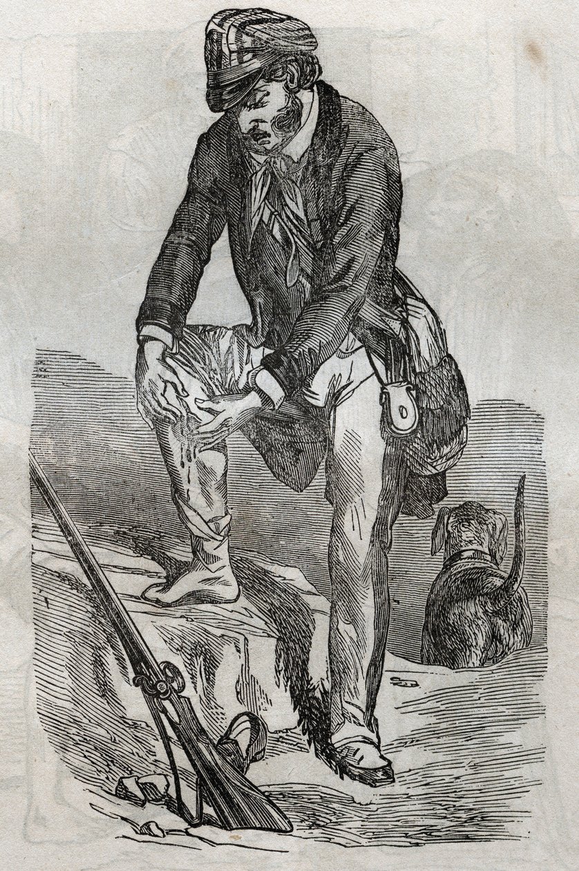 Wściekłość - leczenie ukąszeń dokonanych przez rozwścieczone zwierzę - rany uciskające jego ranę - grawer w „La Sante Universelle - Medical Guide for Families”” 1852 autorstwa Unknown artist
