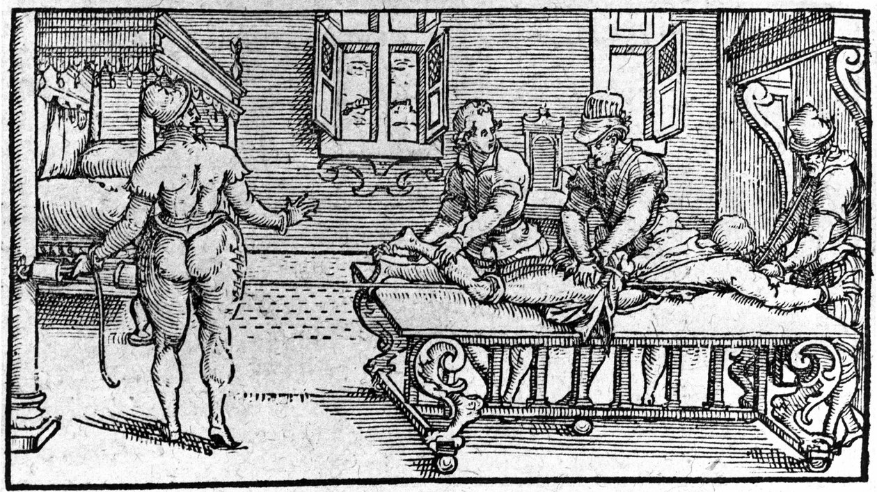 Redukcja zwichnięcia, w „Traktacie medycznym” Ambroise Paré, około 1560 r. autorstwa Unknown artist
