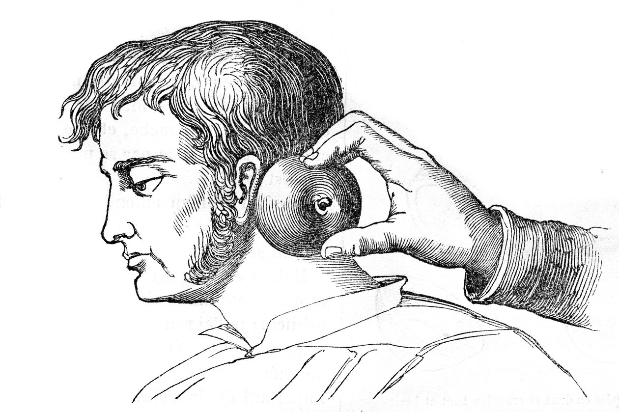 Saignee locales - aplikacja pijawek z jabłkiem - grawer w "La Santo Universelle - Medical Guide for Families" 1852 autorstwa Unknown artist