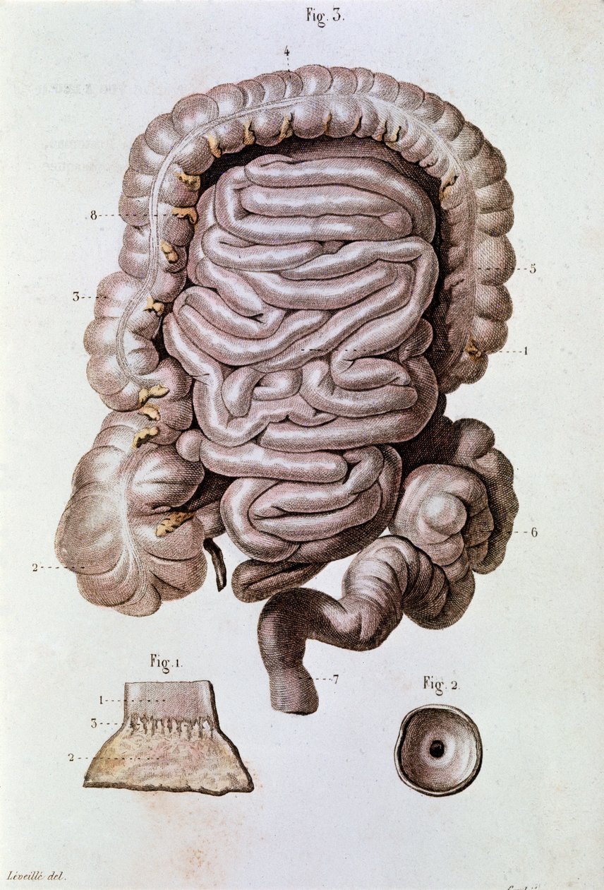 Badanie jelita (jelita), dwunastnicy i jelita cienkiego (grawerowanie) autorstwa Unknown artist