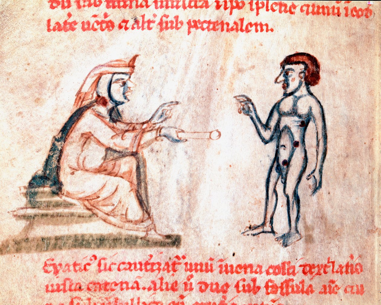 Lekarz przypala pacjenta gorącym żelazkiem w bolące miejsca Miniatura z rękopisu "De Medicina cauteriorum secundum Brunum, Rugerius et Rolthe" XIII-wieczny Paryż, B.N. autorstwa Unknown artist