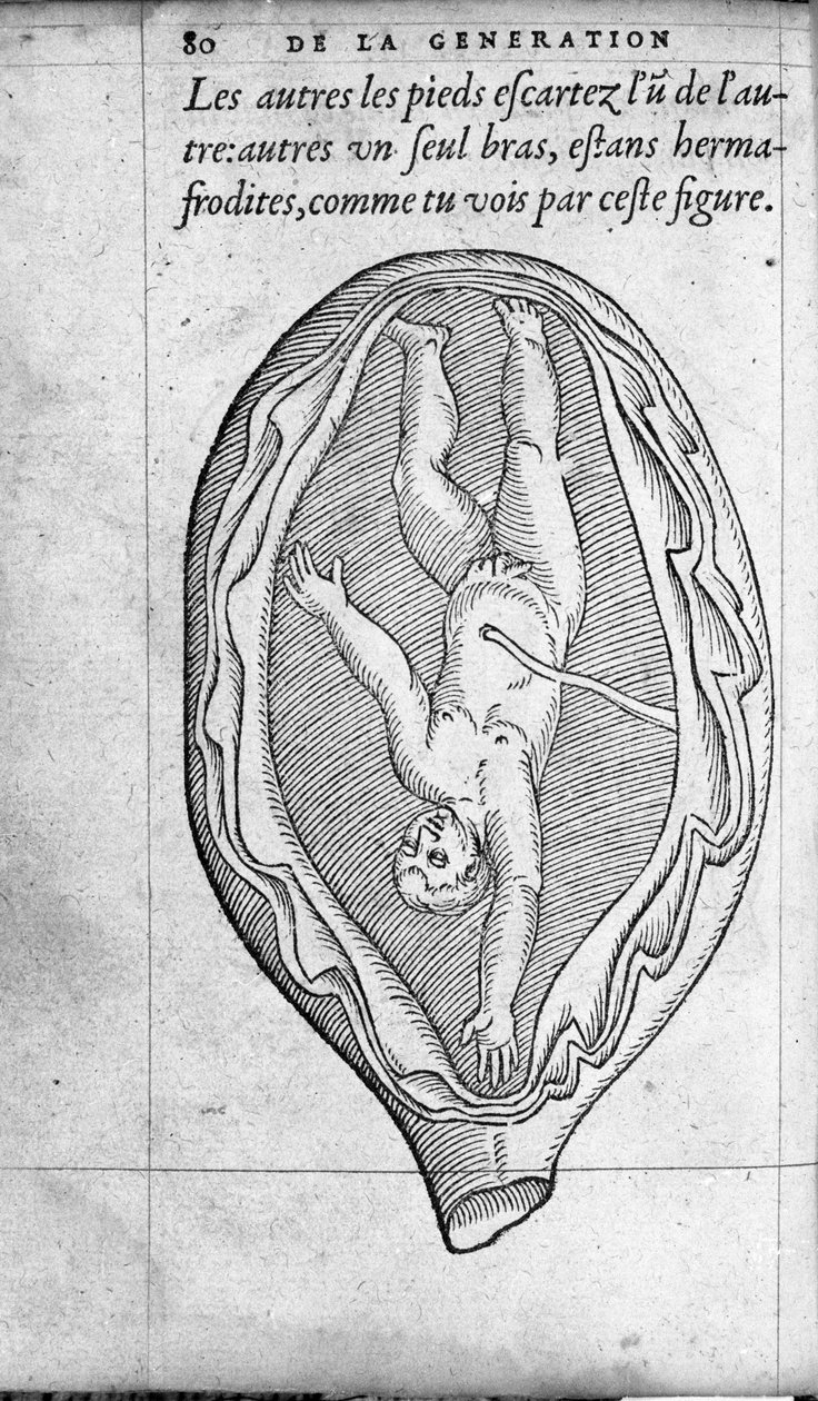 Pozycja płodu w macicy podczas ciąży. Rycina z „De la generation des enfants” autorstwa francuskiego lekarza i chirurga Ambroise Pare (1509-1590) XVI wiek autorstwa Unknown artist