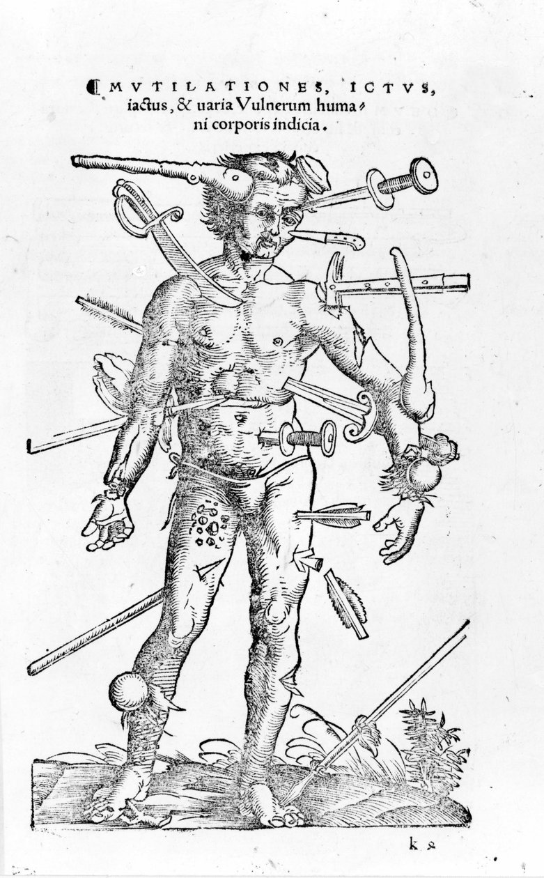 Wszelkiego rodzaju traumatyczne obrażenia wojenne. 16 wiek autorstwa Unknown artist