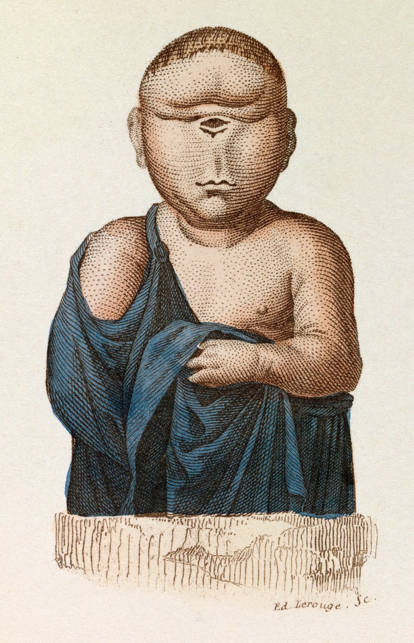 Dziecko z jednym okiem, sklasyfikowane według nomenklatury Linneusza i klasyfikacji Cuviera (rycina) autorstwa Unknown artist