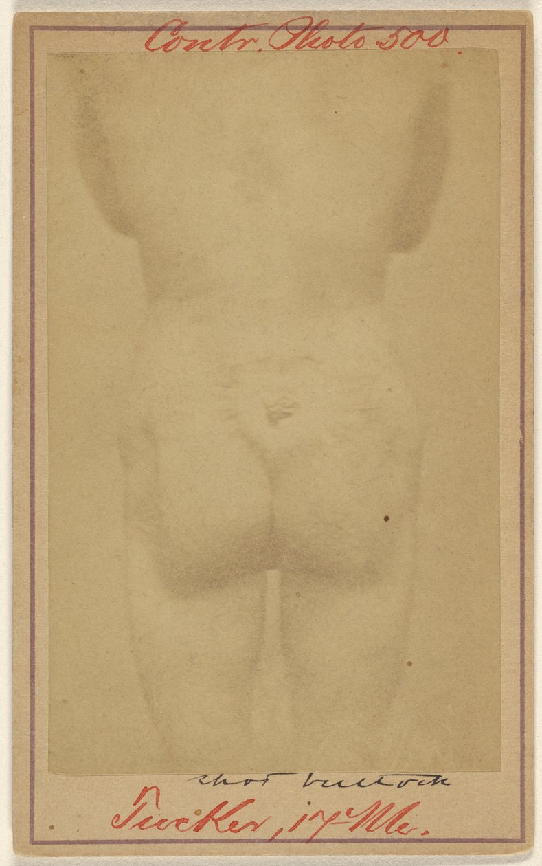 [Jno. E. Tucker, postrzelony w pośladek, ofiara wojny secesyjnej]. autorstwa Unknown artist