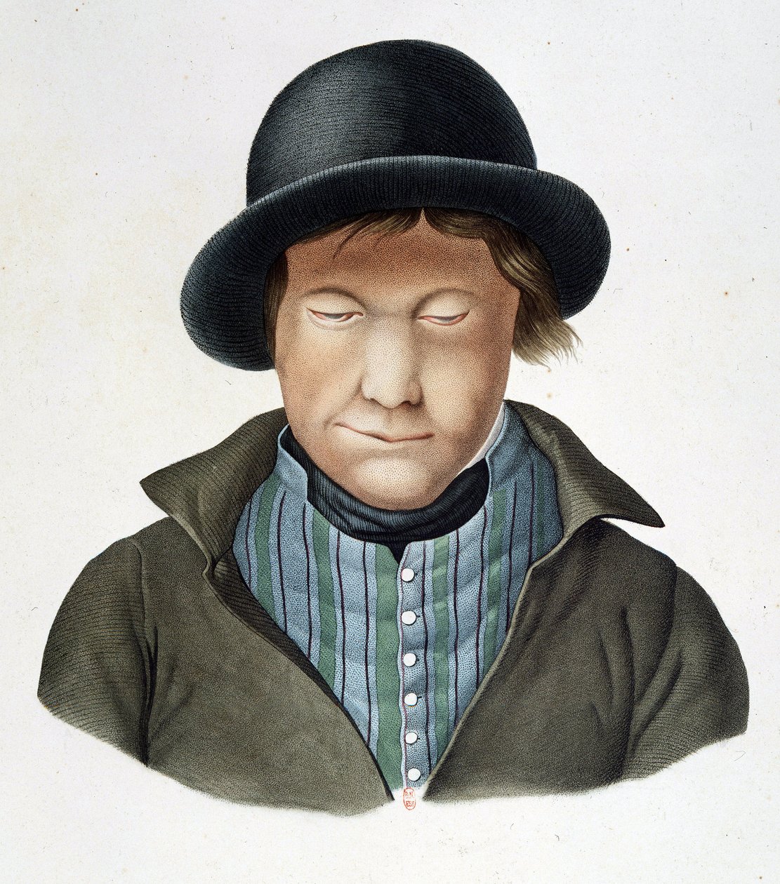 Trędowaci z Islandii, ok. 1840, B.N. autorstwa Unknown artist