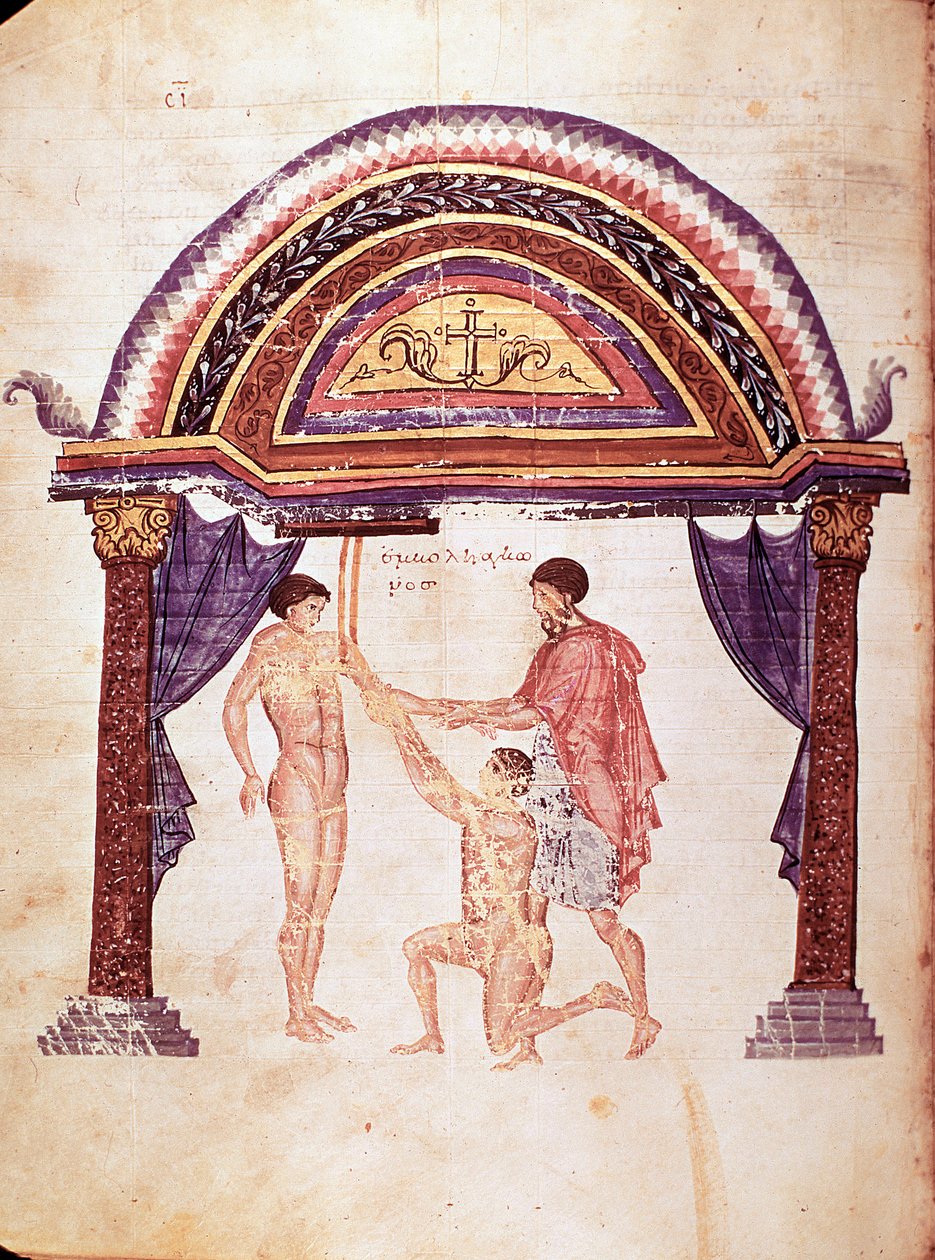 Medycyna: redukcja zwichniętego łokcia, powieszenie pacjenta za ramię (rękopis) autorstwa Unknown artist