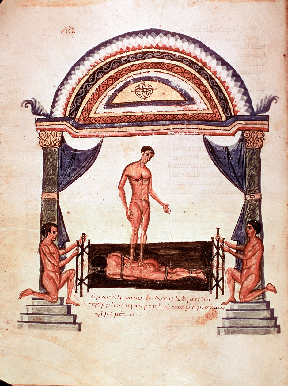 Medycyna: redukcja zwichniętego kręgosłupa - pacjent jest umocowany na drewnianej desce, jeden z terapeutów stoi mu na plecach (rękopis autorstwa Unknown artist