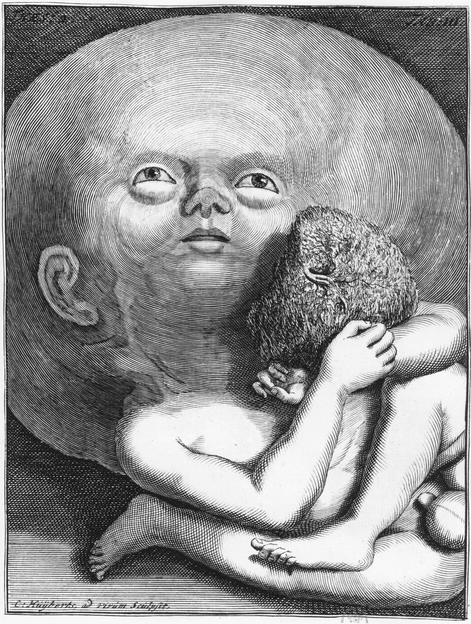 Potwór: Antropologia wodogłowia dziecięcego - grób, n.p.m., koniec XVIII w. autorstwa Unknown artist